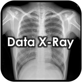 Data X-Ray
